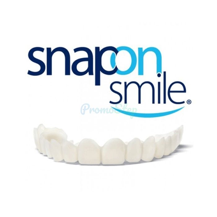 ⦗ Snap-On Smile ⦘ ⦗ veneers ⦘